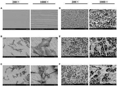 Impact of High-Altitude Hypoxia on Early Osseointegration With Bioactive Titanium